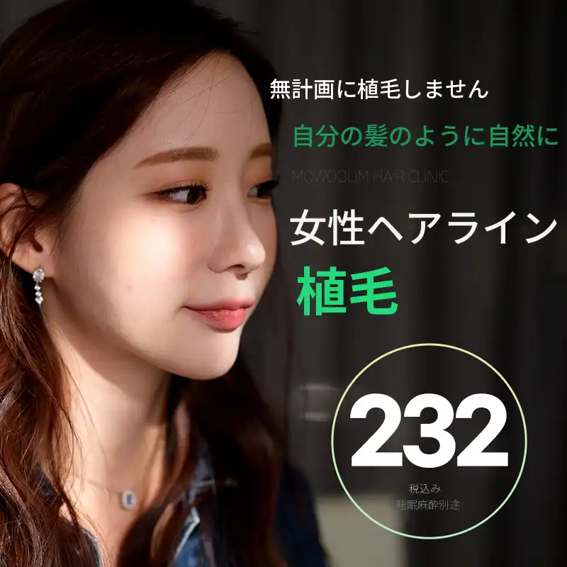 女性ヘアライン無切開毛髪移植