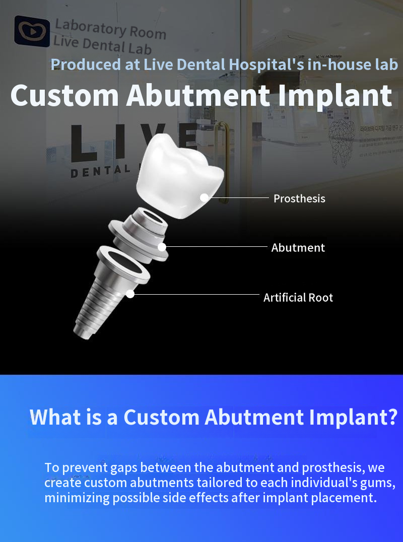 Domestic genuine all-inclusive implant with simple bone grafting