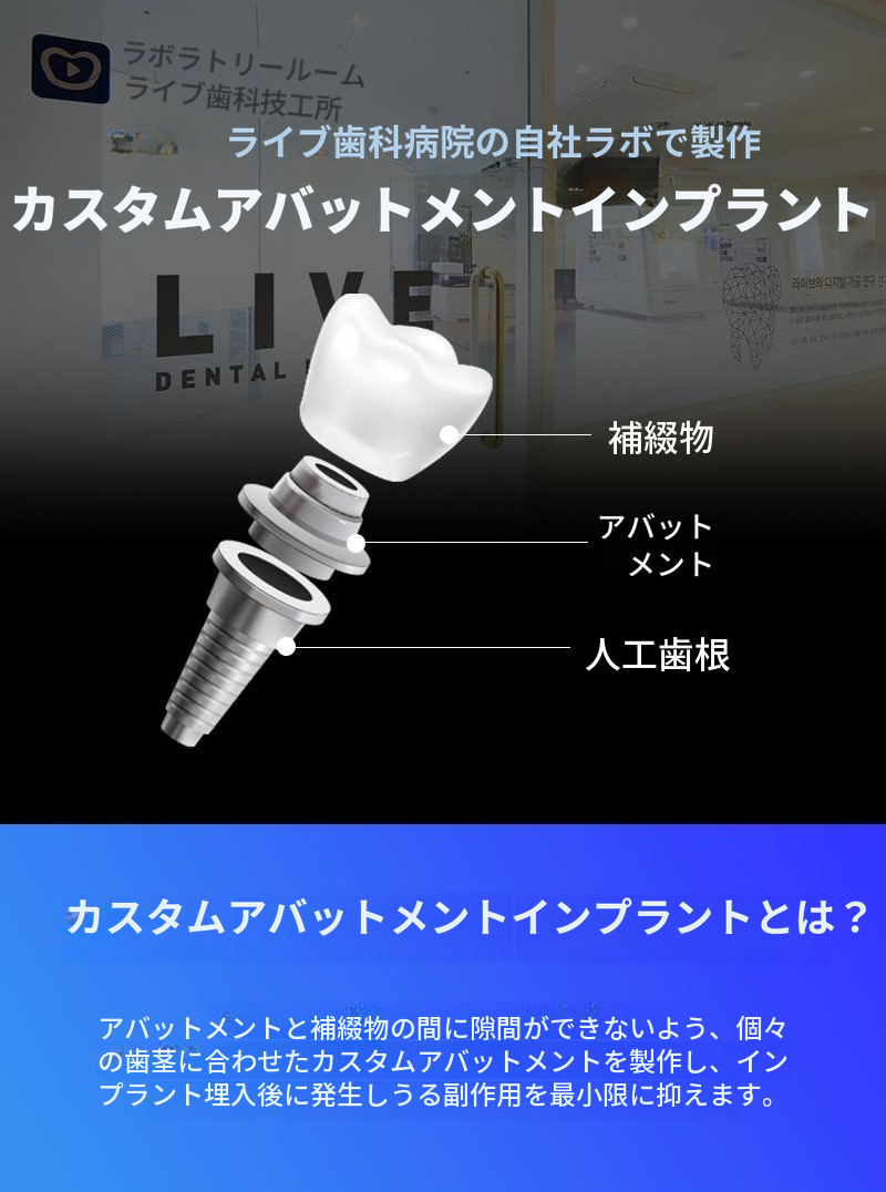 国産正規品 簡単骨移植を含む全体インプラント
