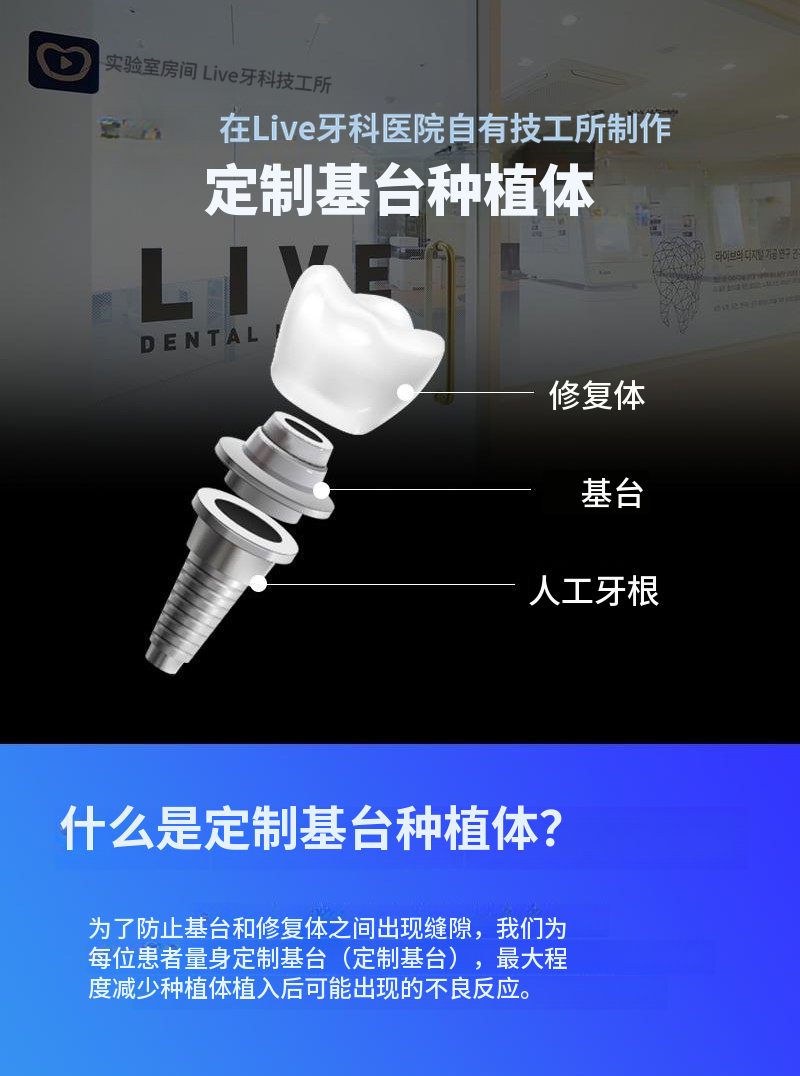国产正品包含简单骨移植的全口植牙