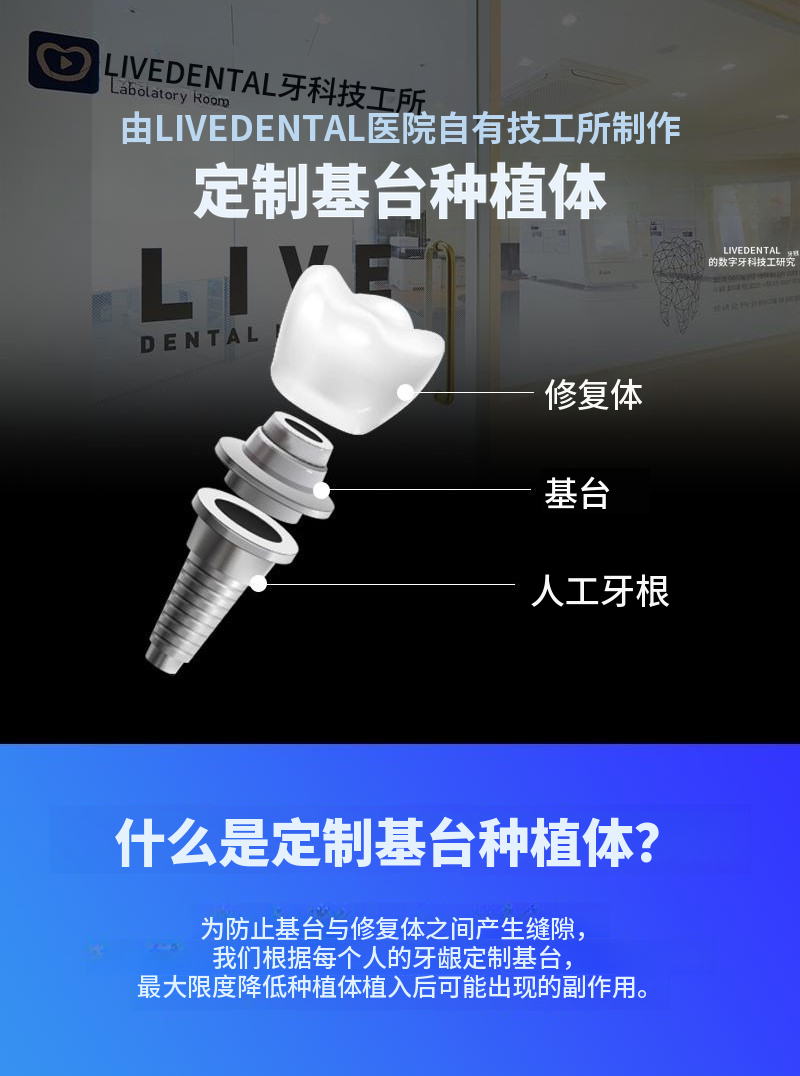 国产正品全口种植牙，包含简单骨移植