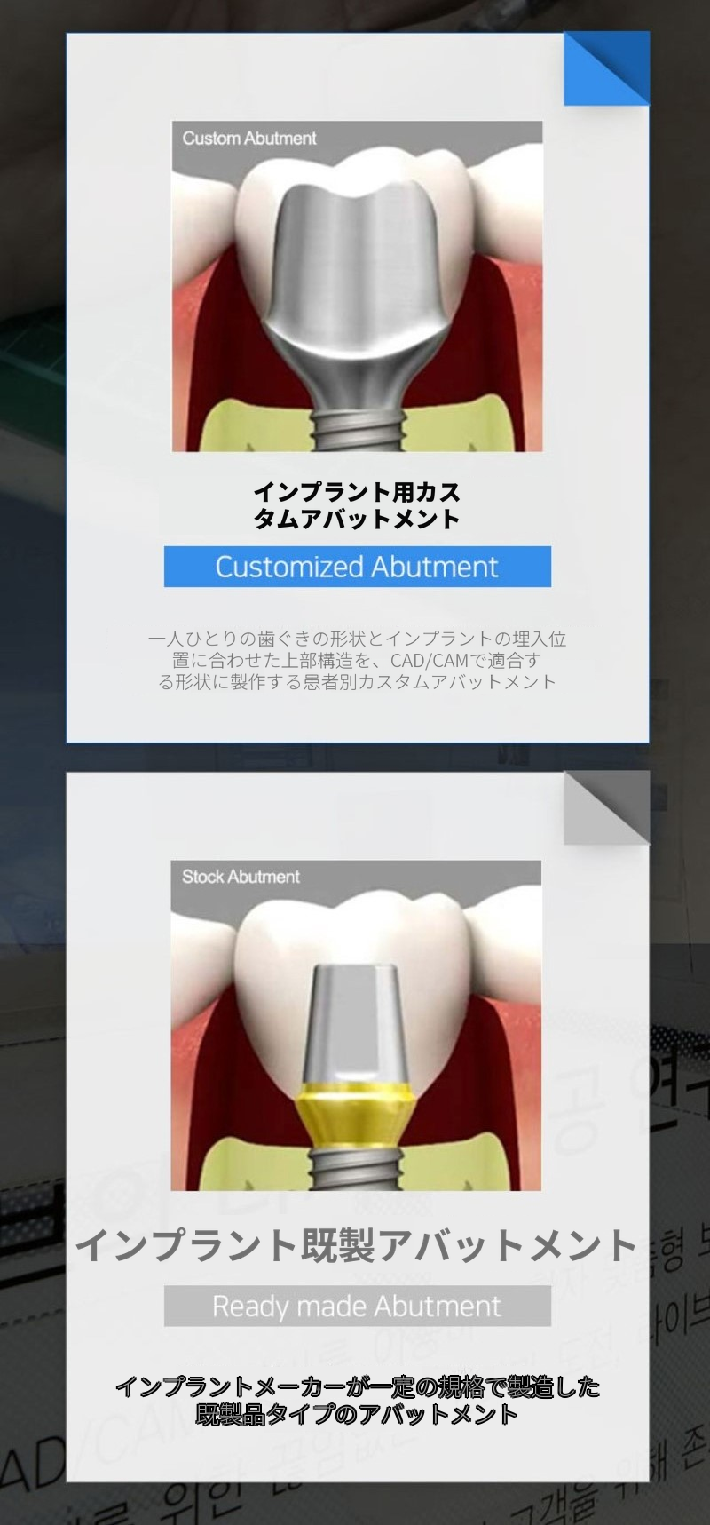 国産正規品・簡単な骨移植込みの全顎インプラント