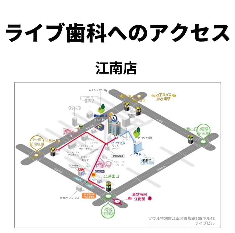 国産正規品・簡単な骨移植込みの全顎インプラント