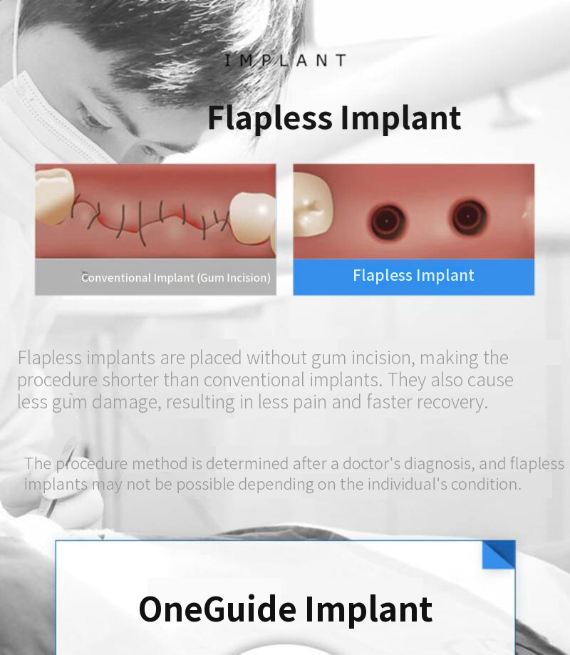 Domestic genuine all-inclusive implant with simple bone grafting
