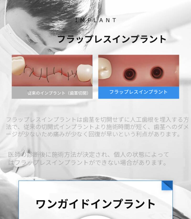 国産正規品 簡単骨移植を含む全体インプラント