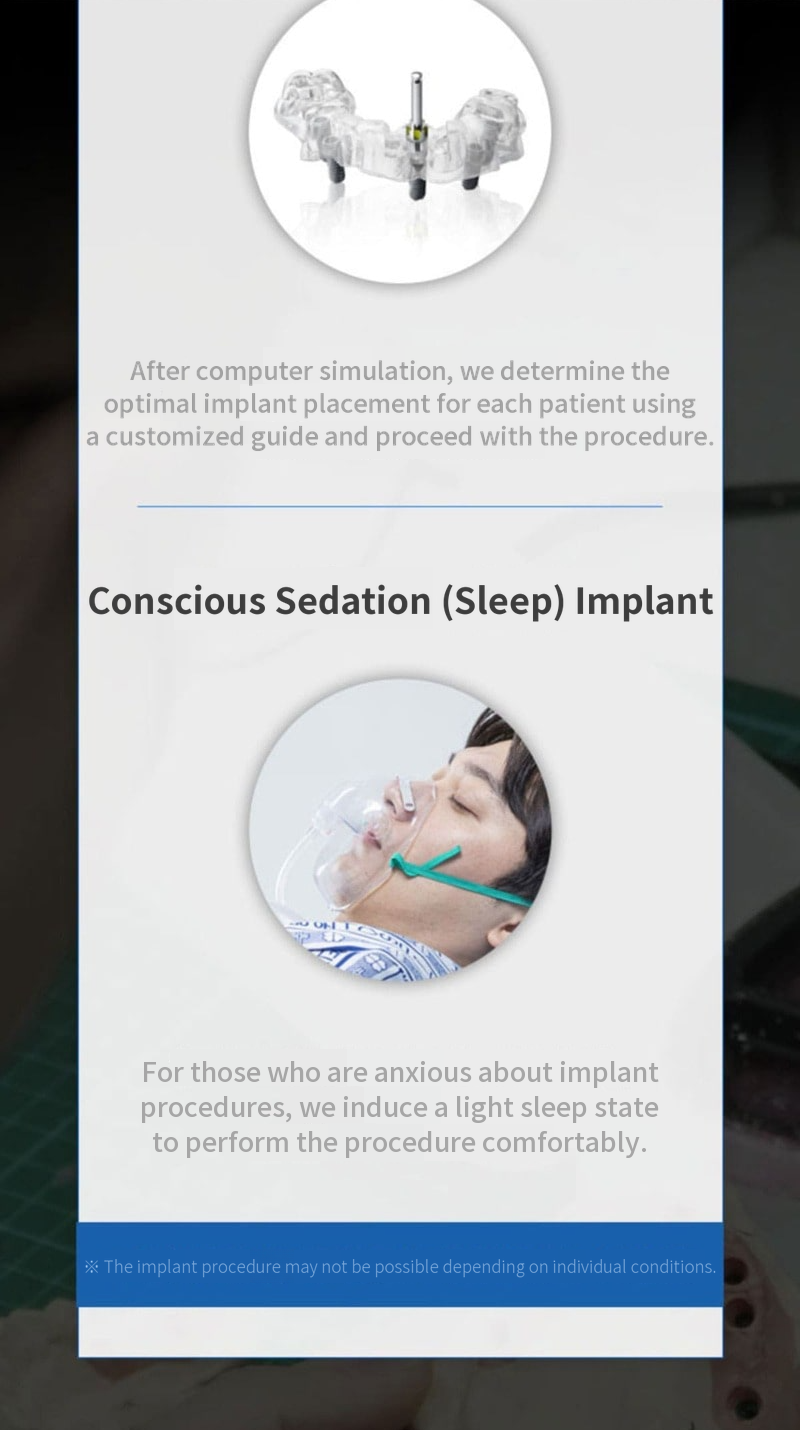 Domestic genuine all-inclusive implant with simple bone grafting