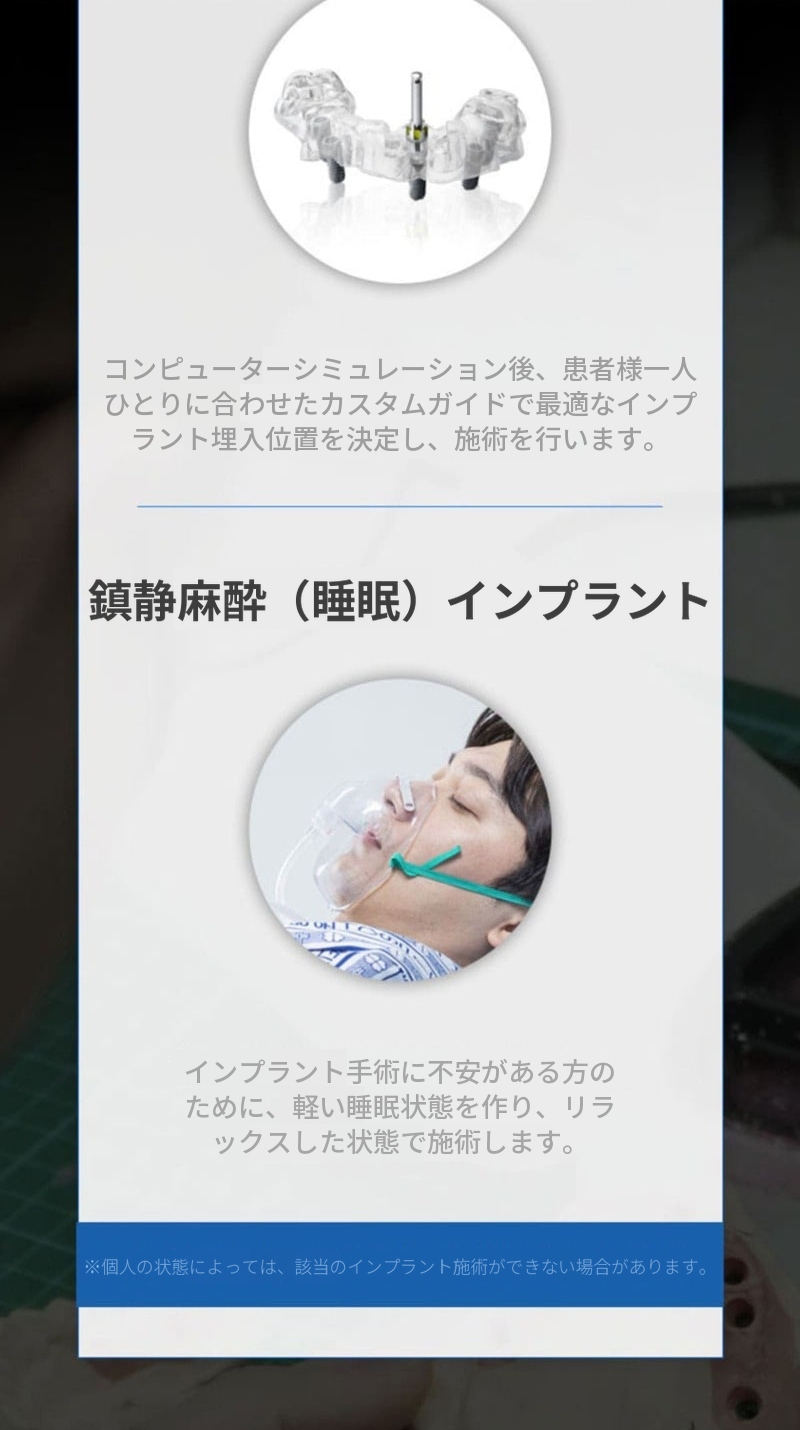 国産正規品 簡単骨移植を含む全体インプラント