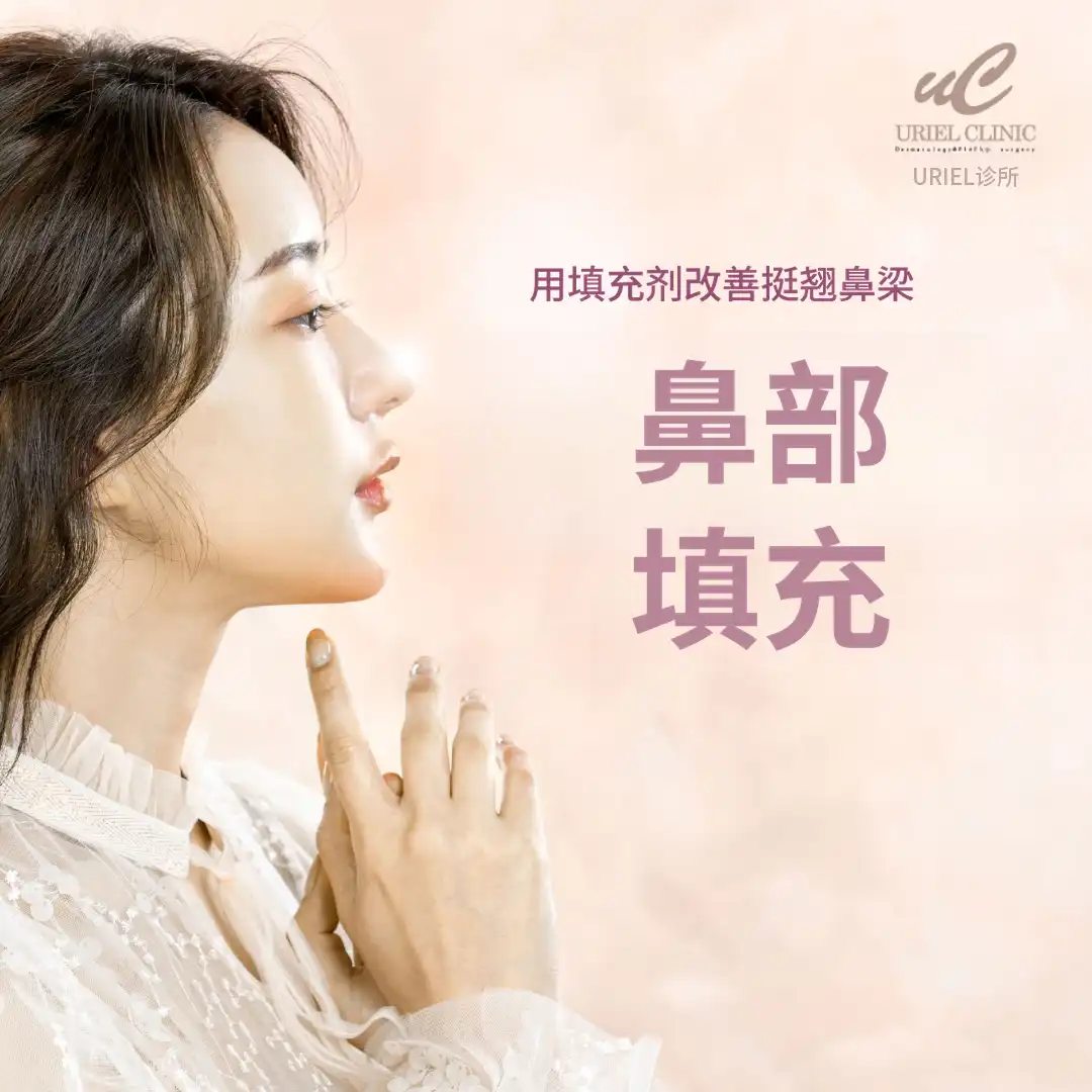 鼻填充剂
