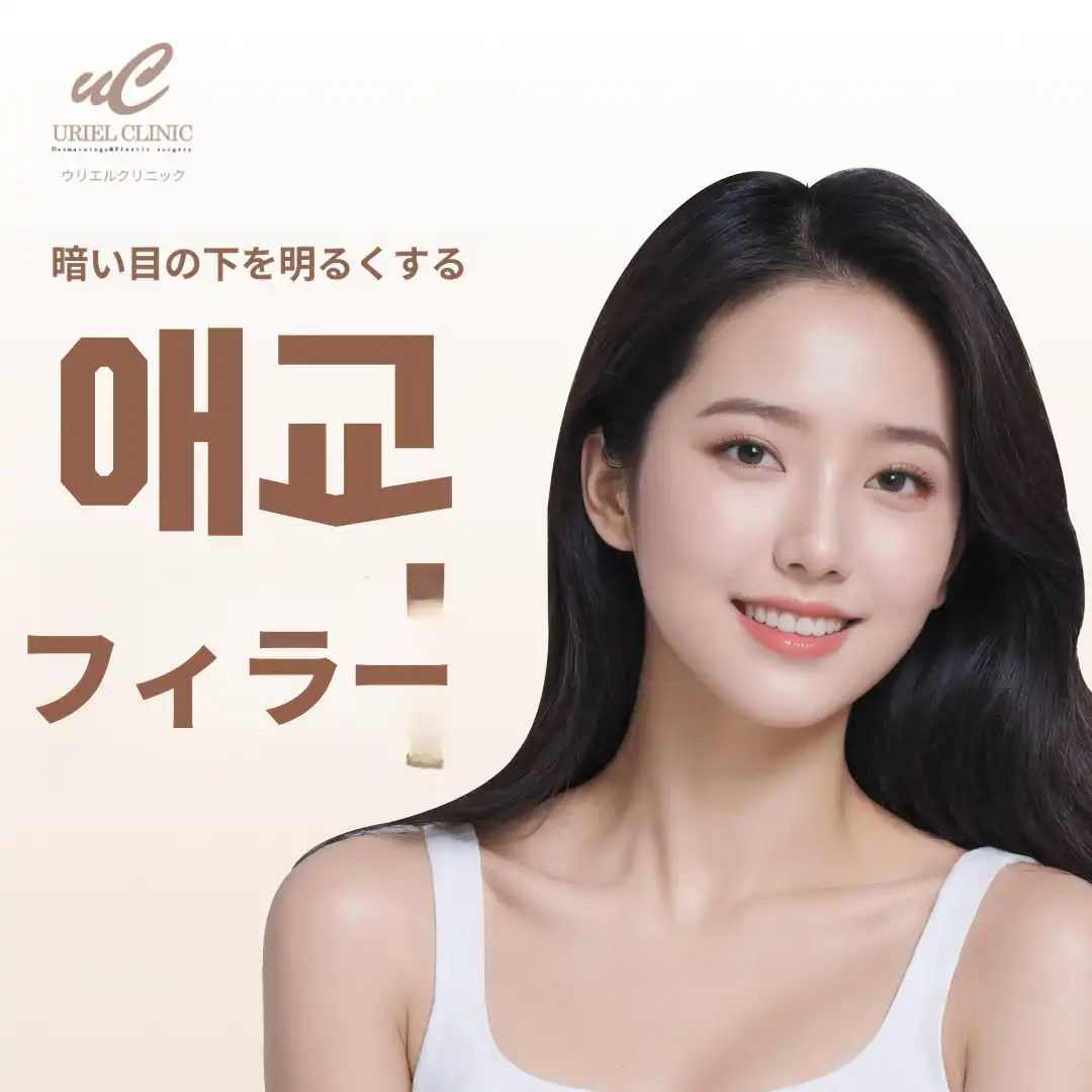 アキュフィラー