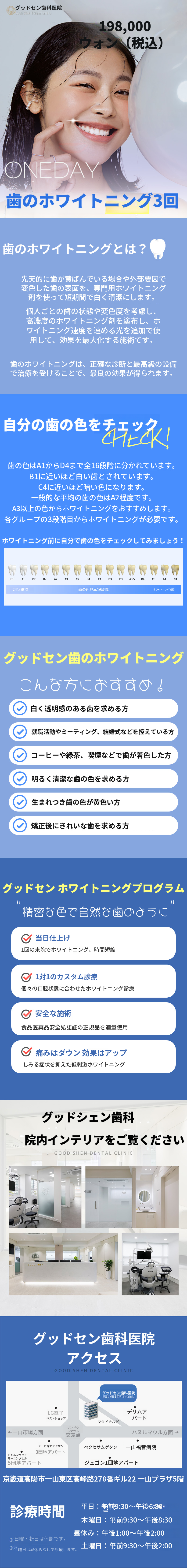 堂々とスマイルワンデイ歯のホワイトニング3回