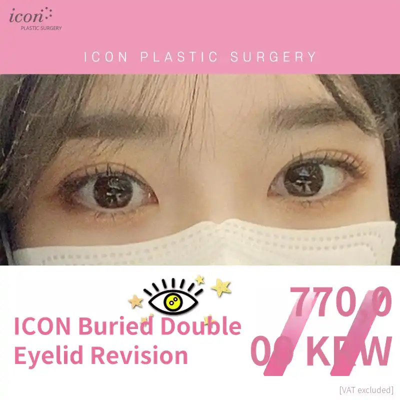 Icon Reoperation with Insertion