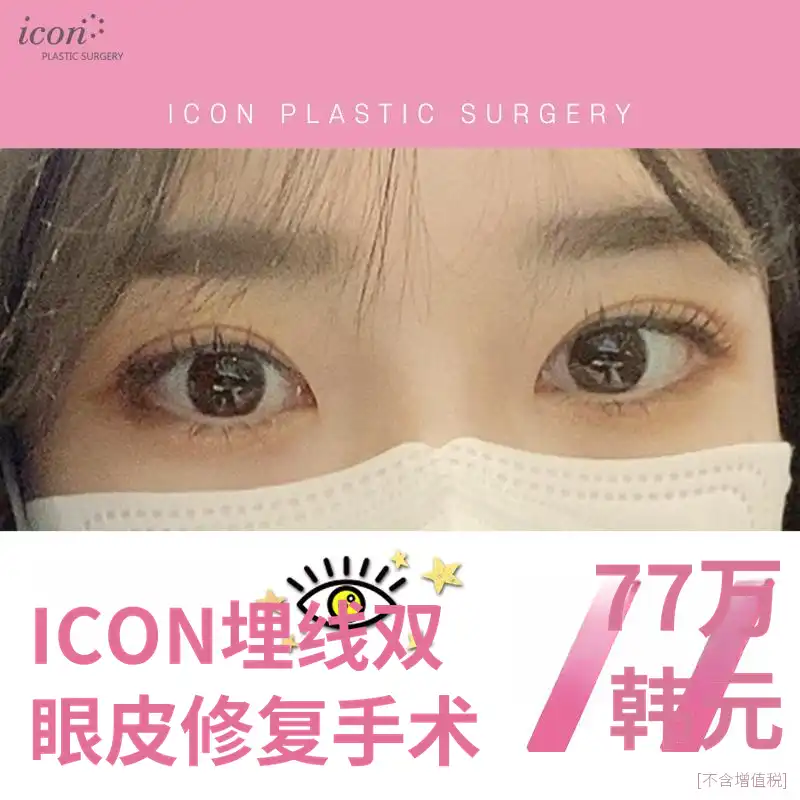 图标埋线修复手术