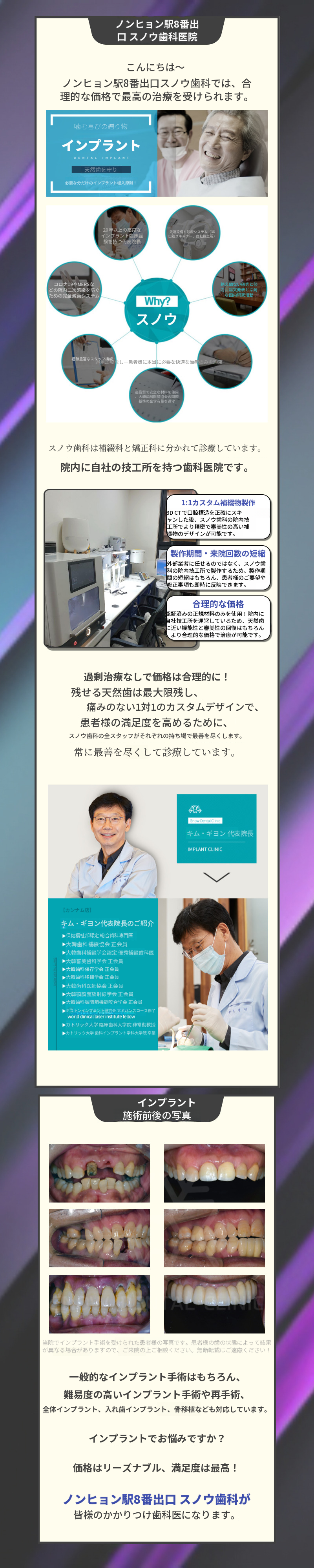 私の歯のように快適なインプラント!