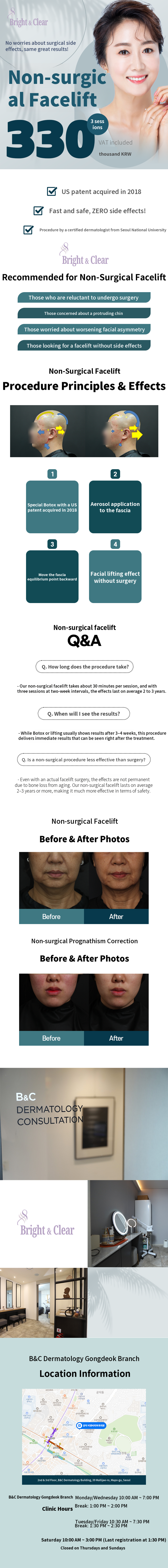 [Gongdeok BNC Dermatology] Non-Surgical Facelift