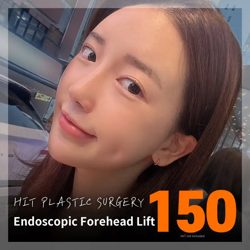 Heat_Endoscopic Forehead Lifting