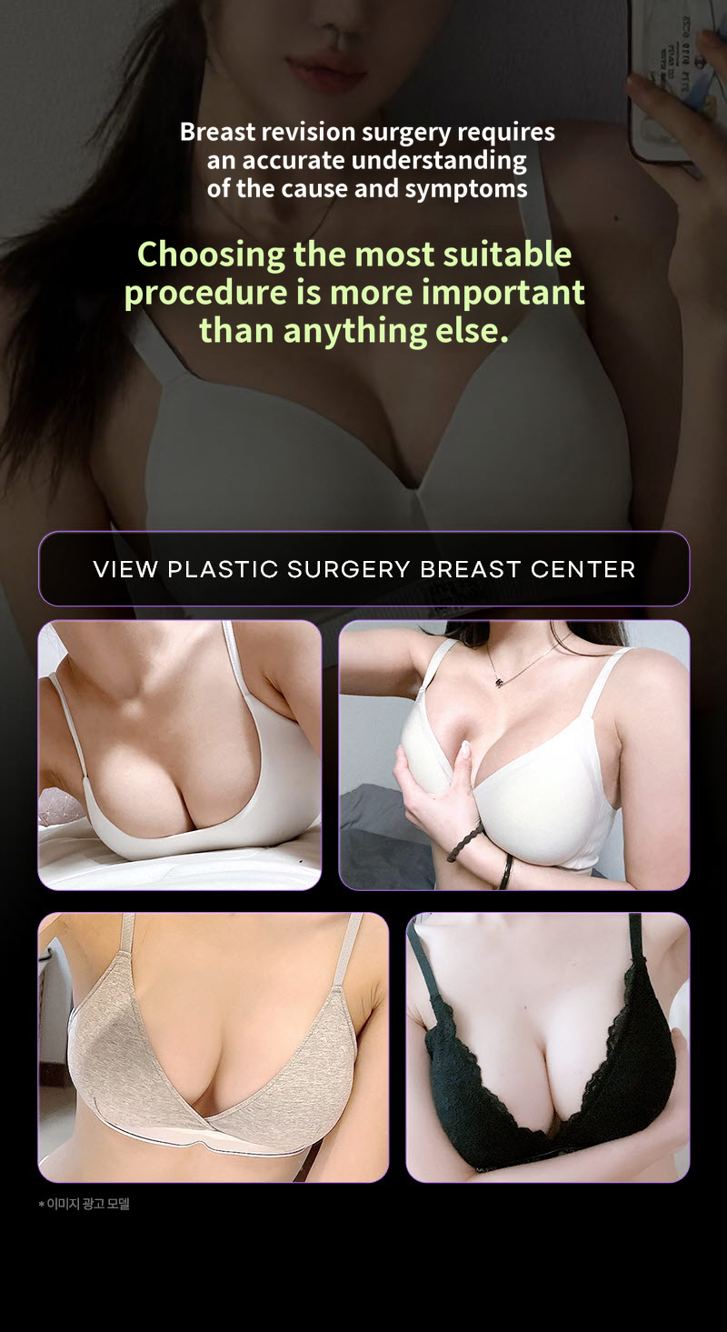 ❤View❤Motiva Breast Revision Surgery