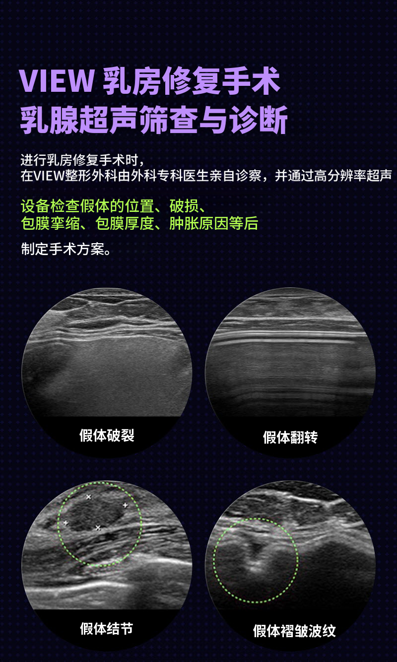❤视图❤Motiva胸部再手术