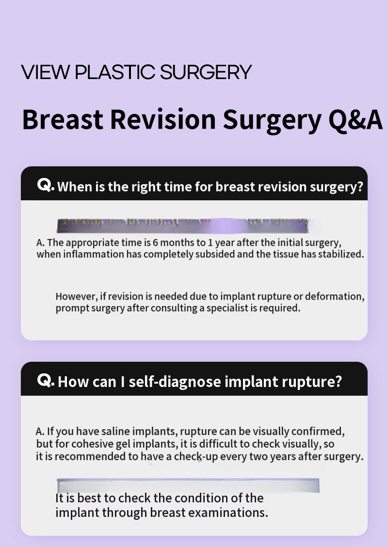 ❤View❤Motiva Breast Revision Surgery