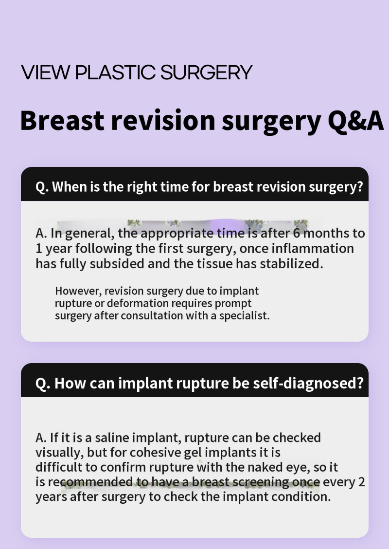 ❤View❤Motiva Breast Revision Surgery