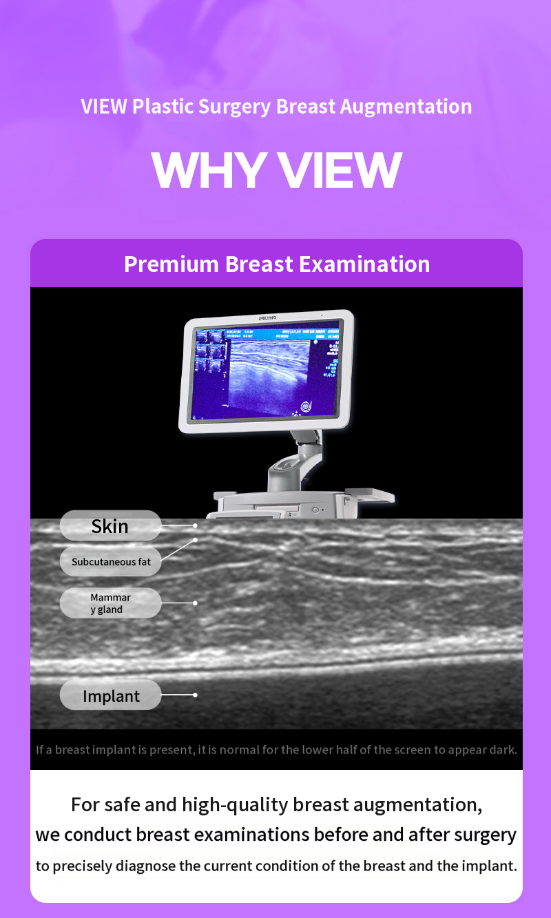 ❤View❤Motiva Breast Revision Surgery