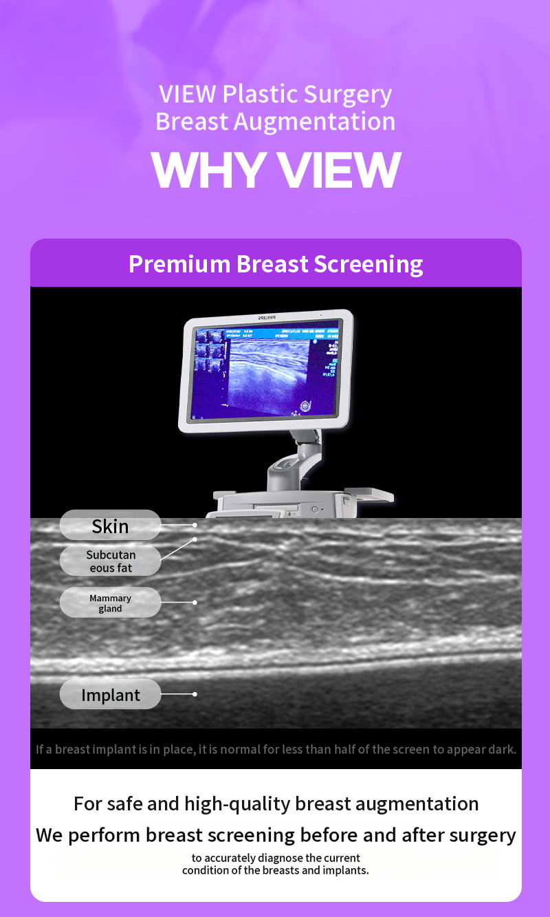 ❤View❤Motiva Breast Revision Surgery