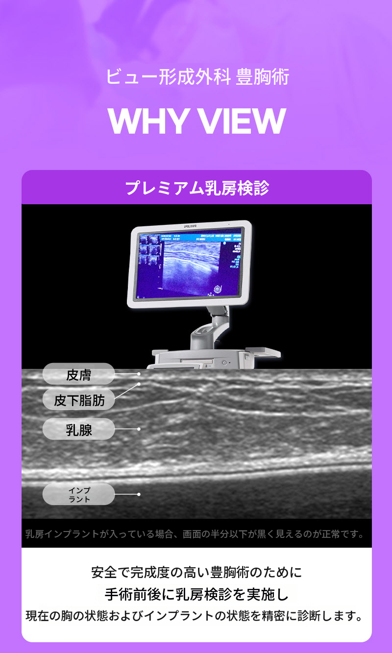 ❤ビュー❤モティバ 胸再手術