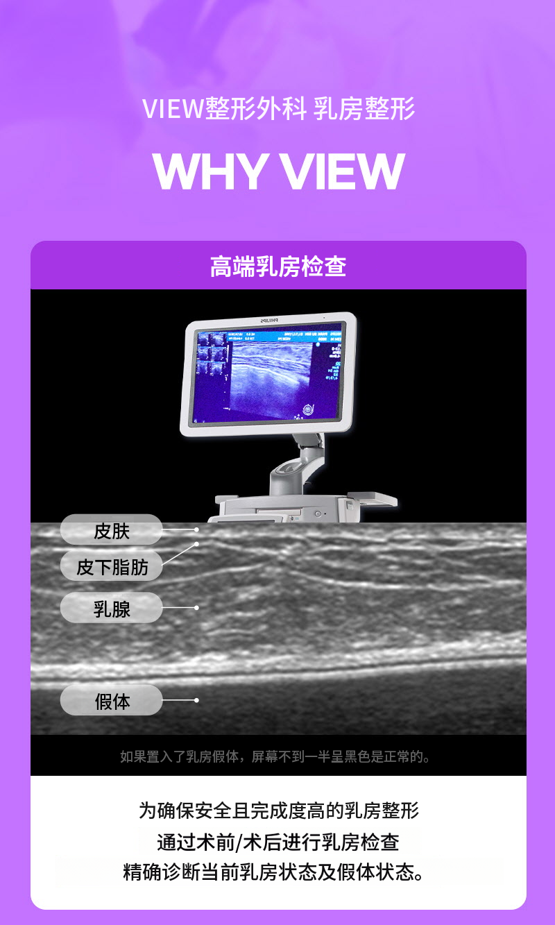 ❤视图❤Motiva胸部再手术