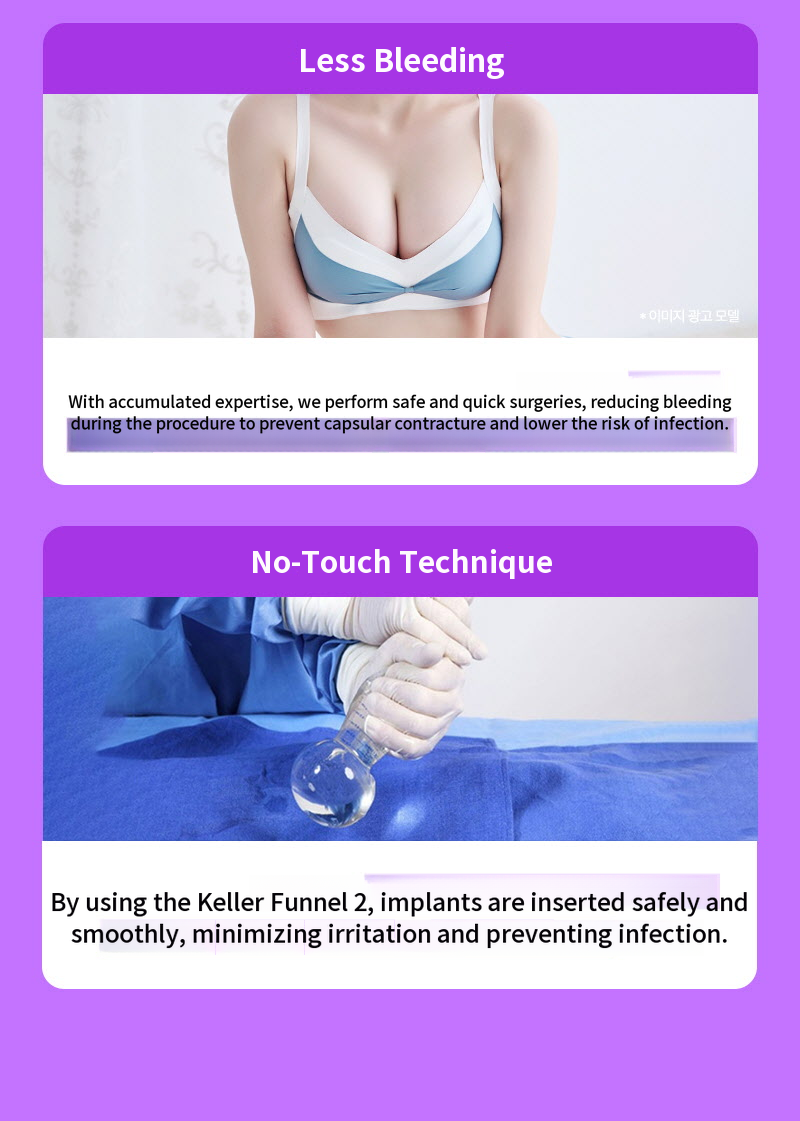 ❤View❤Motiva Breast Revision Surgery