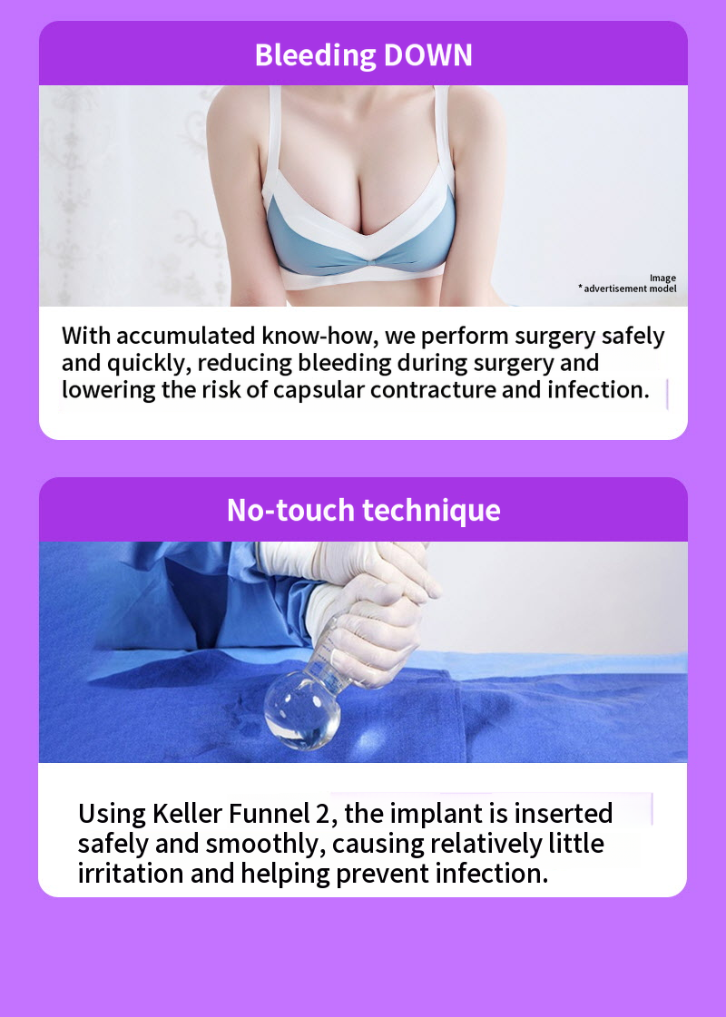 ❤View❤Motiva Breast Revision Surgery