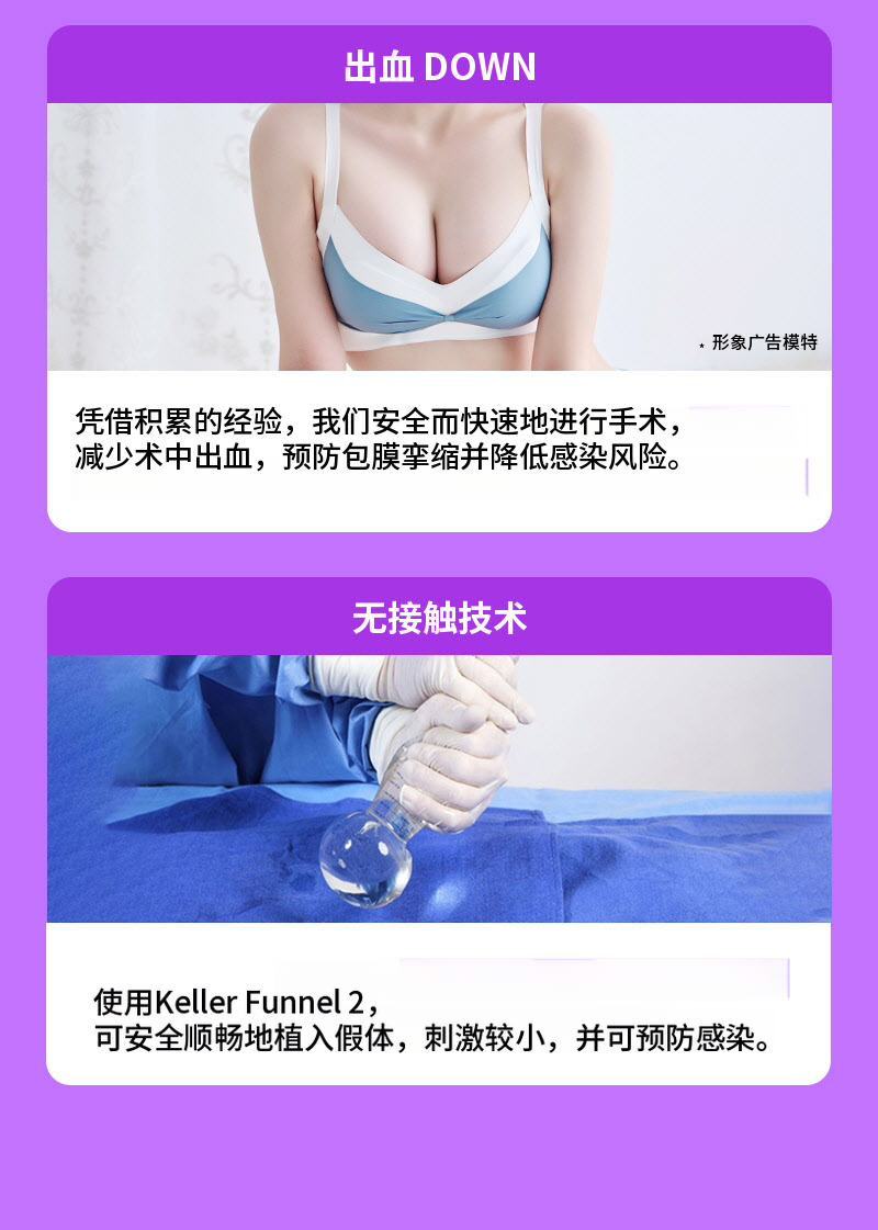 ❤视图❤Motiva胸部再手术
