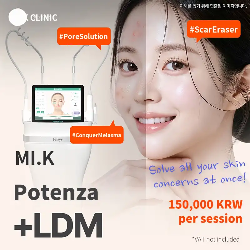 Mikey Acne Scar Improvement_Potenza