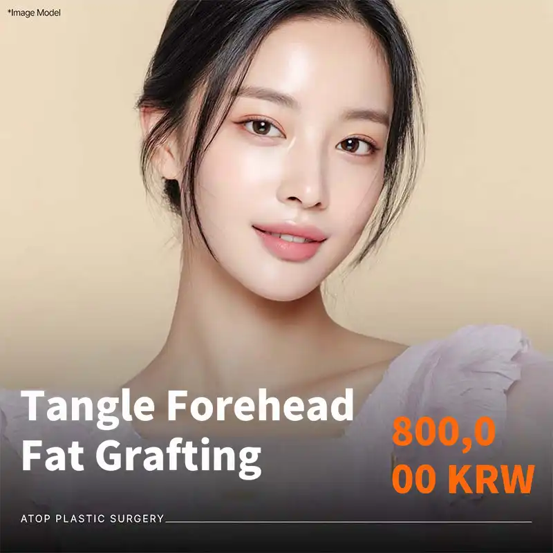 A-Top Tangle Forehead Fat Grafting