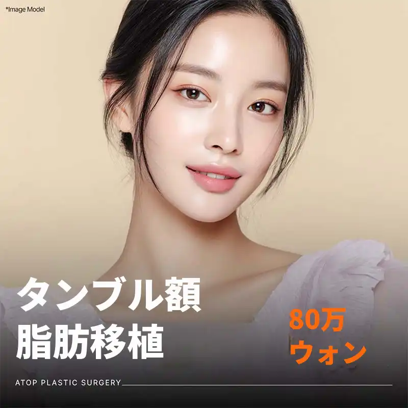 エイトップ テングルおでこ脂肪移植