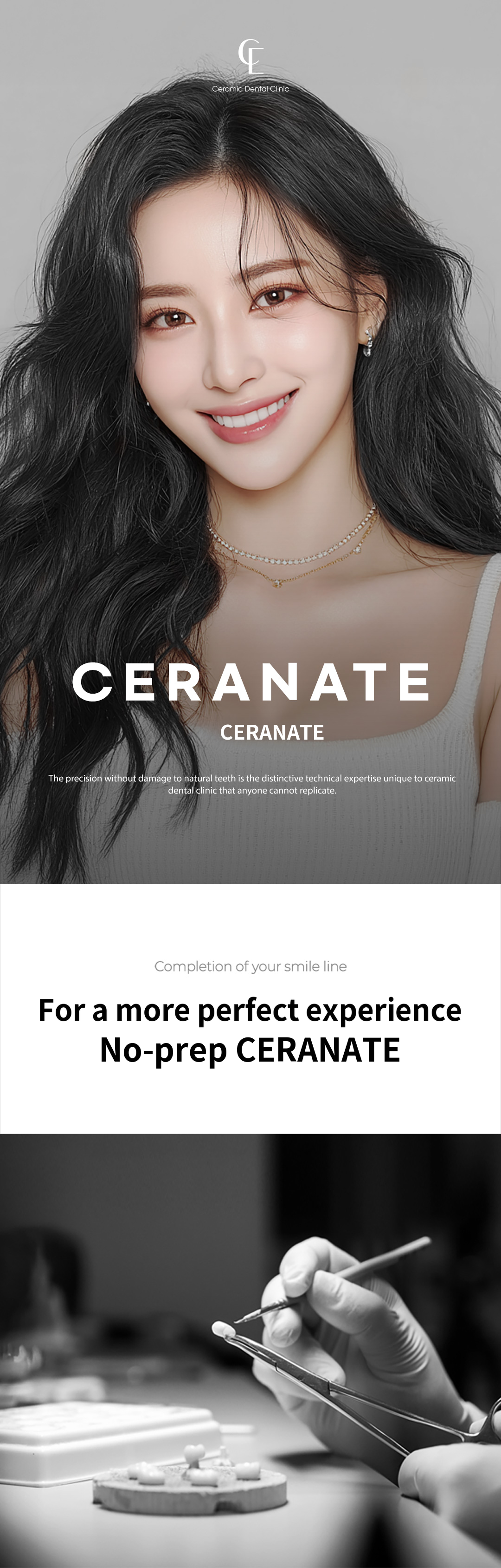 ★Customized Cerinate Veneers with No Additional Cost★