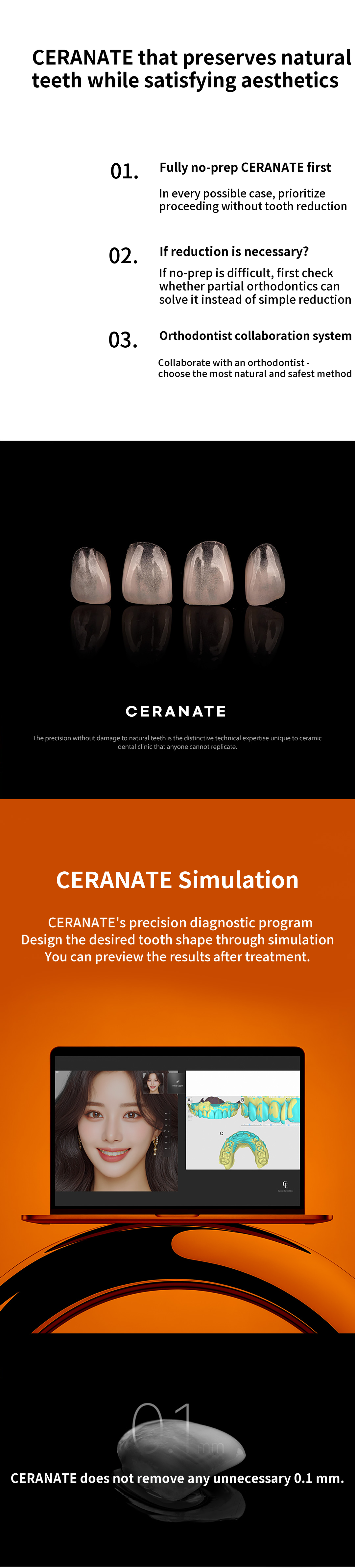 ★Customized Cerinate Veneers with No Additional Cost★
