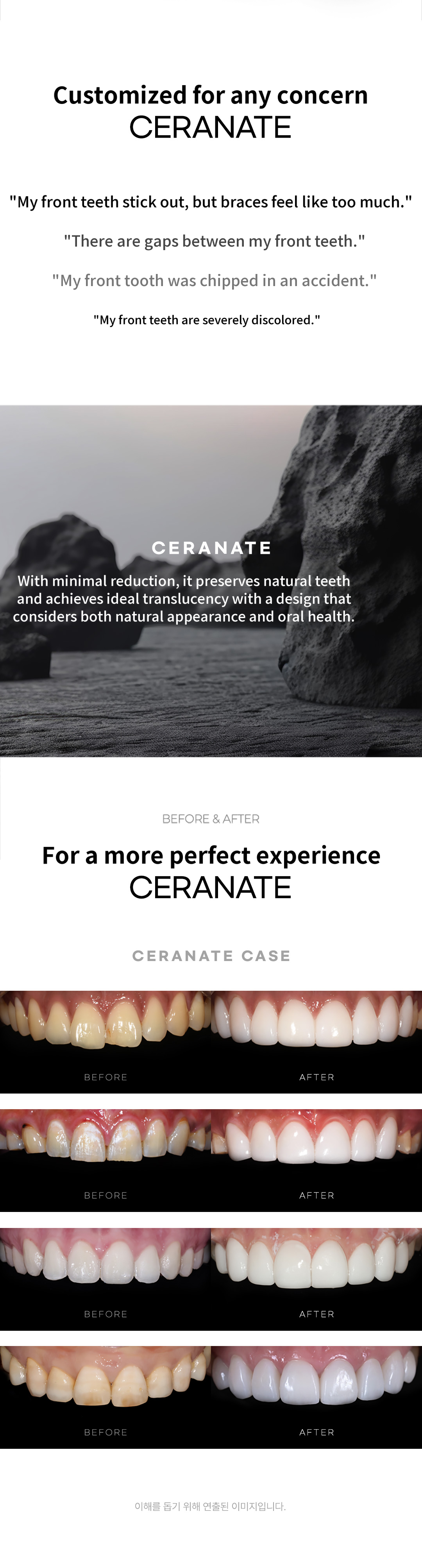 ★No Additional Cost Non-Deleted Serenate★