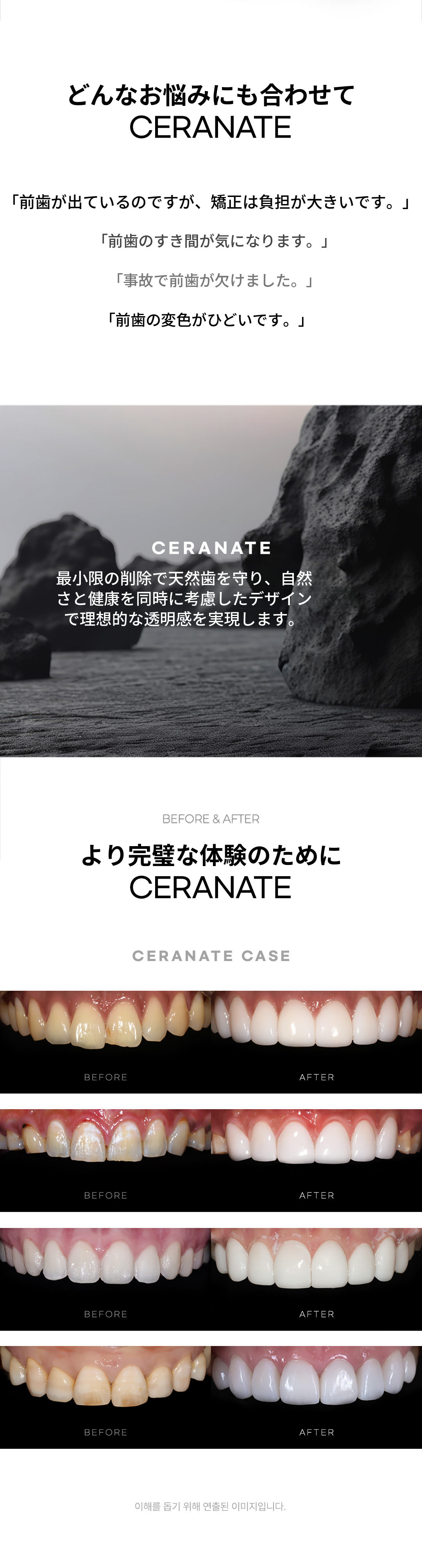★追加費用なしの無削除セラネート★