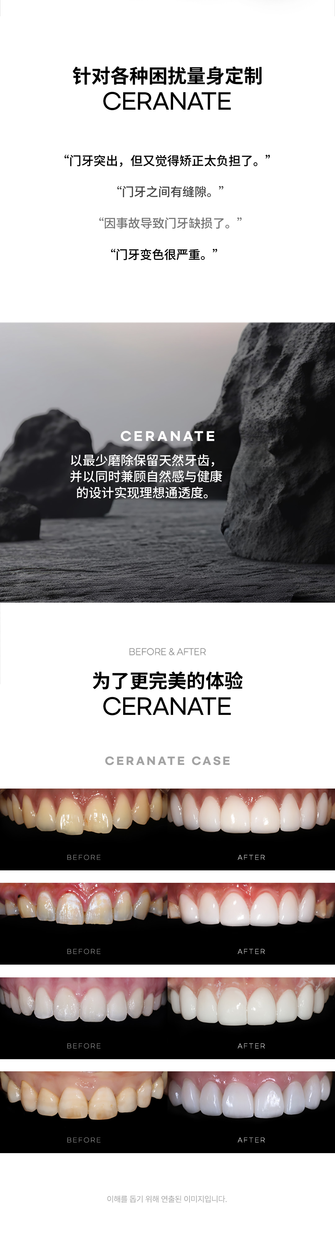 ★无额外费用的无删减赛拉美特★