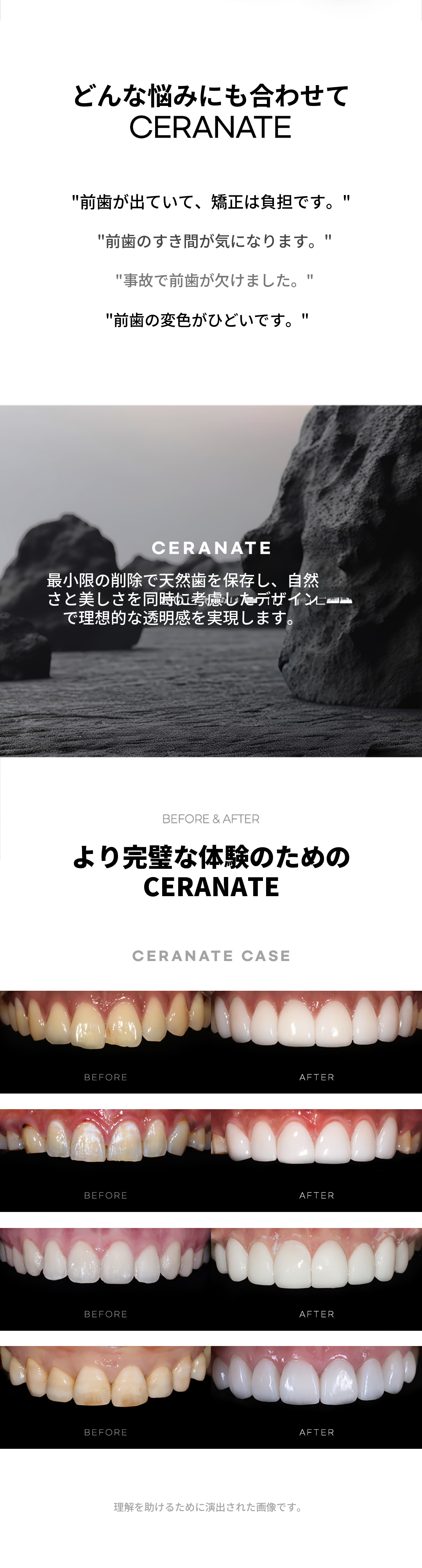 ★追加料金なしのカスタマイズセラネート★