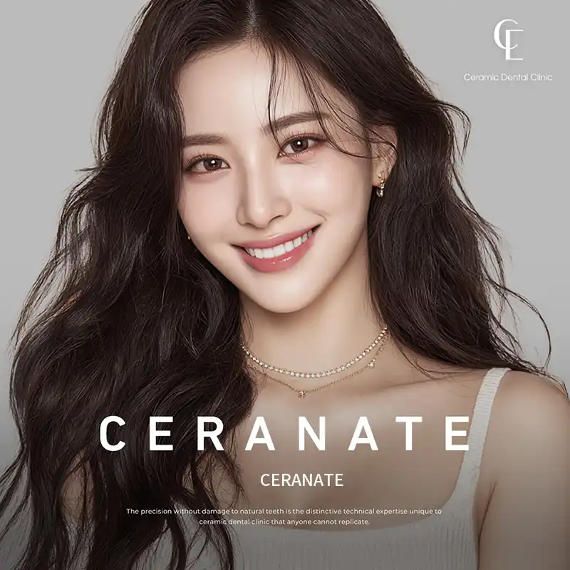 ★Customized Cerinate Veneers with No Additional Cost★