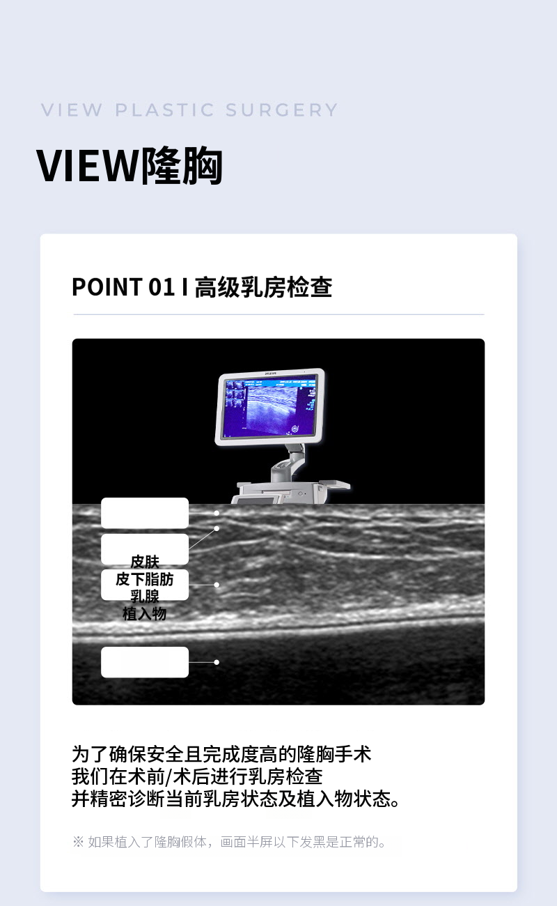 ❤️视图❤️UIU 导师额外