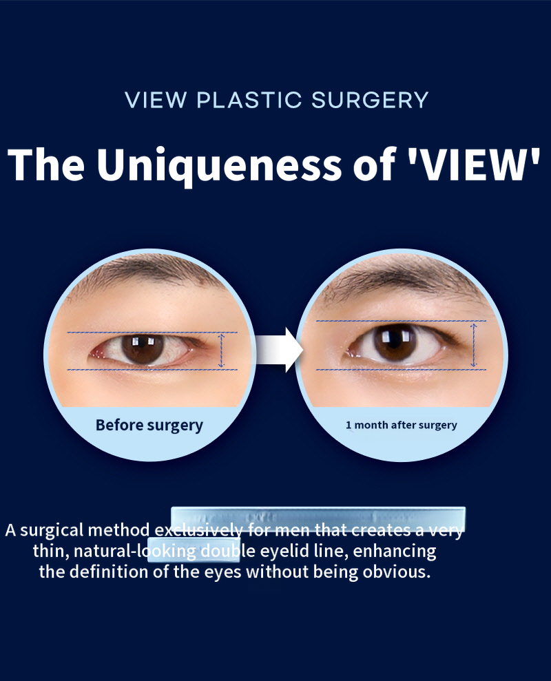 ❤️View❤️ Men's Eye Surgery