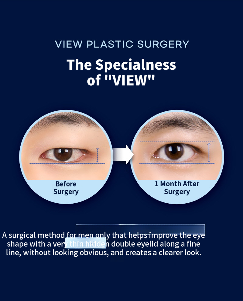 ❤️View❤️Male Eye Surgery