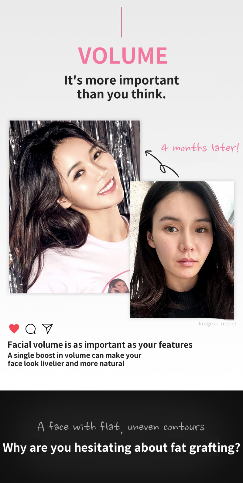 ❤️View❤️Facial Liposuction