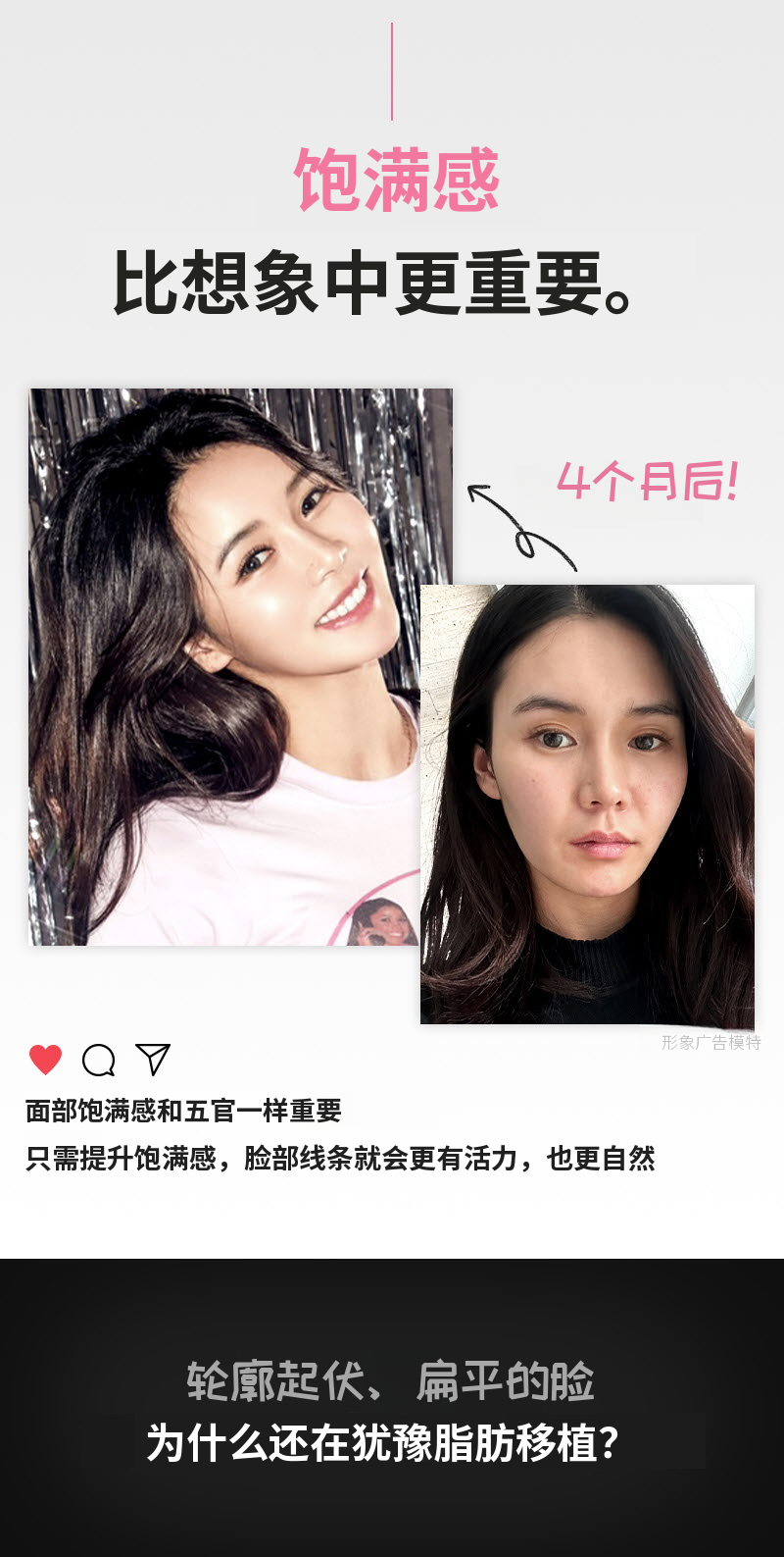 ❤️视图❤️脸部脂肪移植