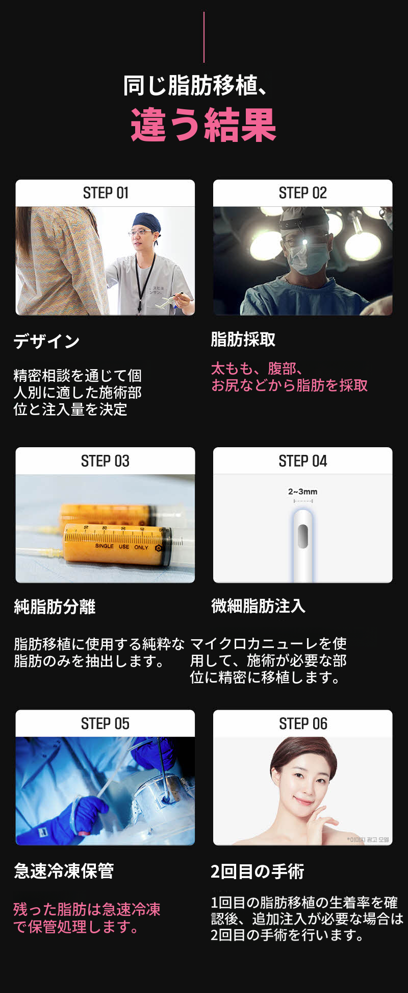 ❤️ビュー❤️顔の脂肪移植