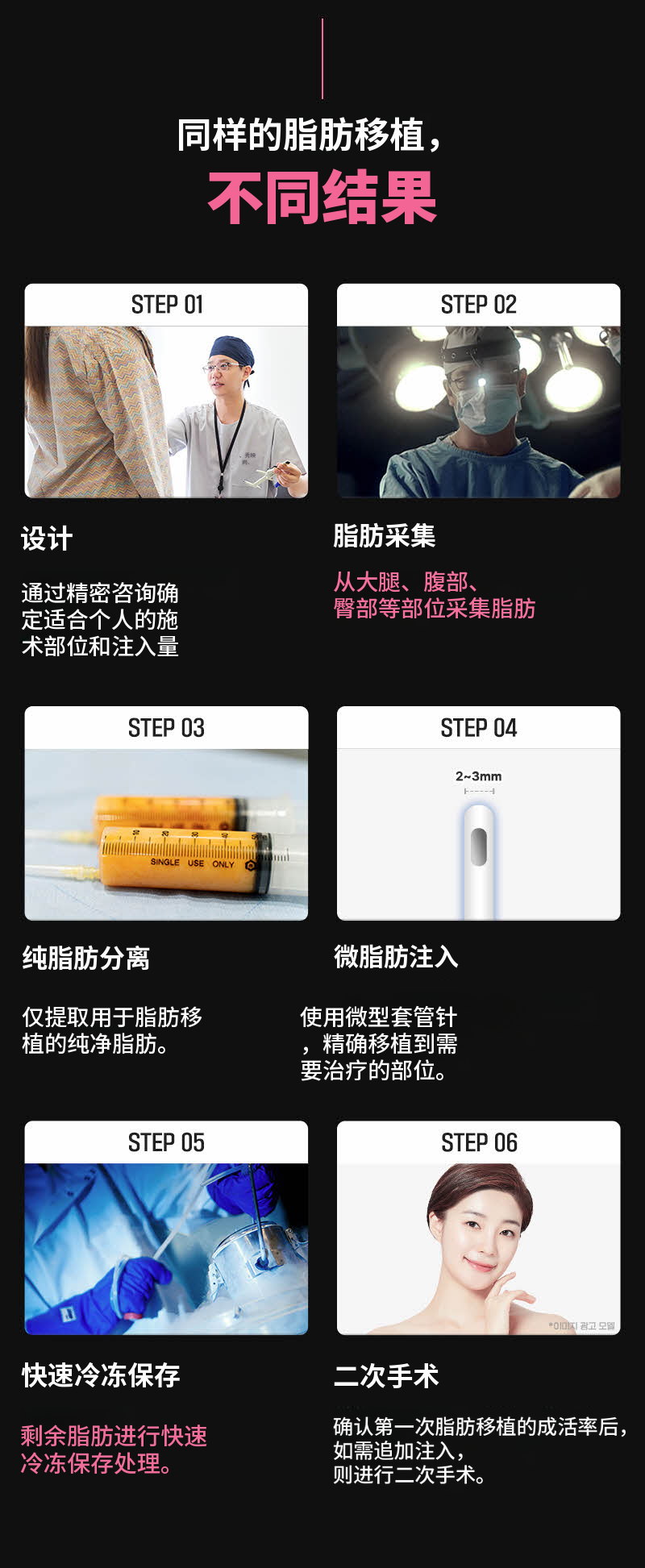 ❤️视图❤️脸部脂肪移植