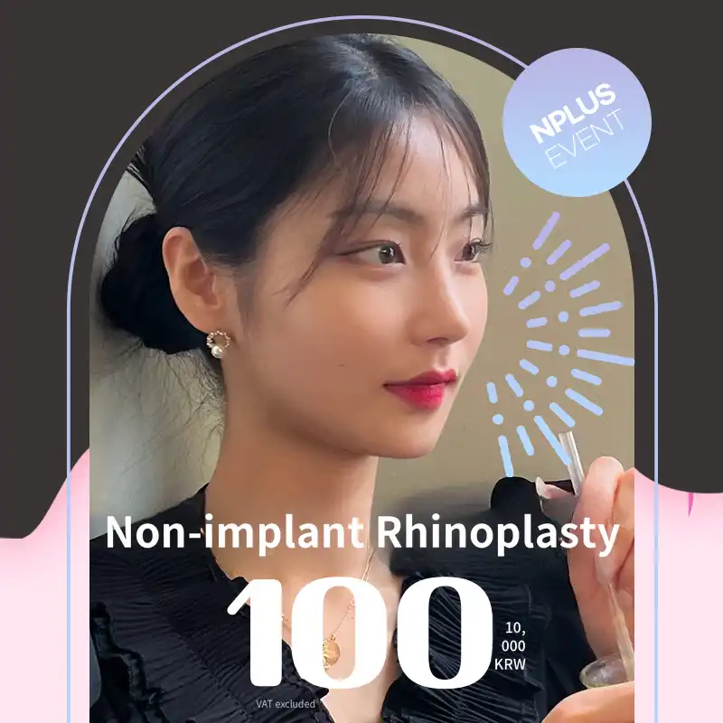 Non-implant rhinoplasty 💛
