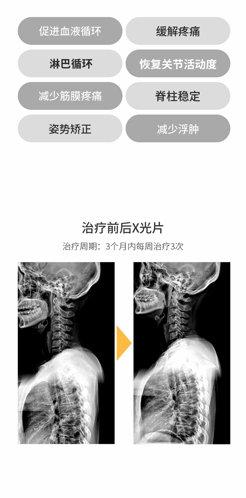 改善疼痛原因的手法治疗