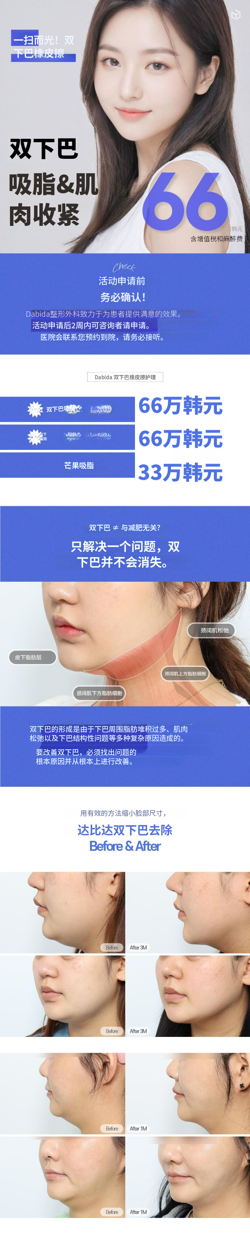 达美达双下巴去除脂肪吸引&肌肉绑带